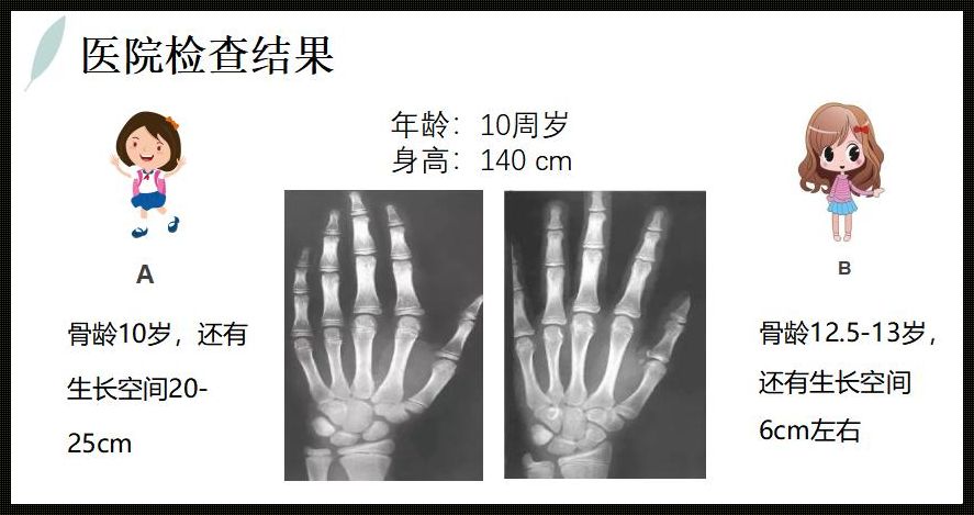 儿童测骨龄揭秘：探寻生长的秘密