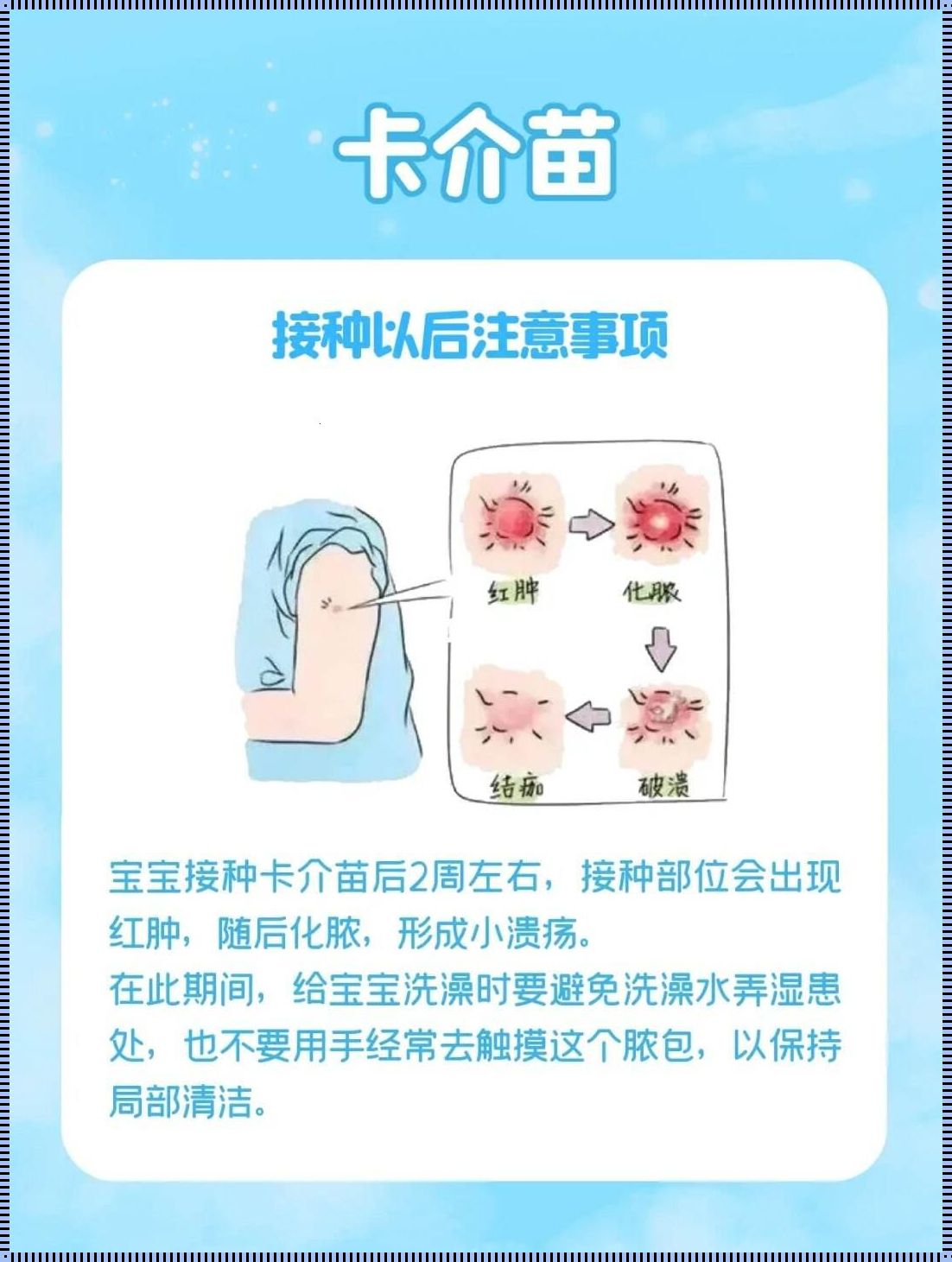 卡介苗：守护健康的神秘盾牌